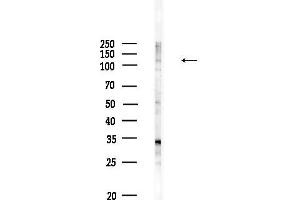 Western blot analysis of lysates from HUVEC cells, using CEP110 Antibody at 1/1000 dilution.