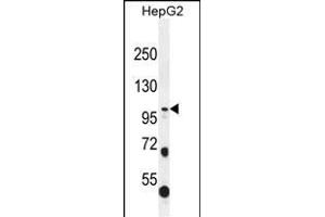 COL21A1 Antibody (N-term) (ABIN656084 and ABIN2845430) western blot analysis in HepG2 cell line lysates (35 μg/lane).