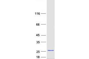 Ankyrin Repeat Domain 39 (ANKRD39) protein (Myc-DYKDDDDK Tag)