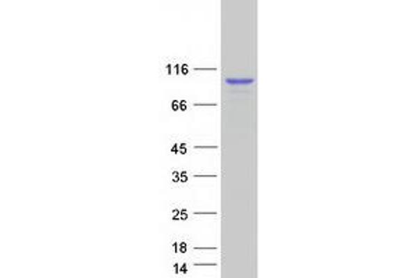 DDX1 Protein (Myc-DYKDDDDK Tag)