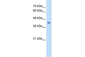 Western Blotting (WB) image for anti-Glutaryl-CoA Dehydrogenase (GCDH) antibody (ABIN2462711) (GCDH antibody)