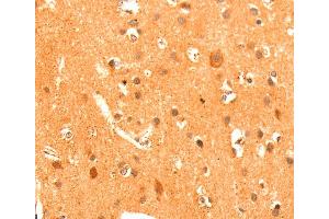 Immunohistochemistry (IHC) image for anti-Glutamate Receptor, Metabotropic 3 (GRM3) antibody (ABIN2428189) (Metabotropic Glutamate Receptor 3 antibody)