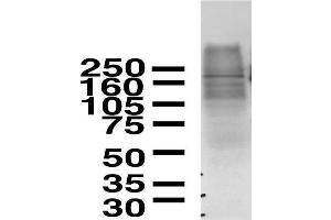 Western Blotting (WB) image for anti-ATPase, Cu++ Transporting, alpha Polypeptide (ATP7A) (AA 42-61), (C-Term) antibody (ABIN1098198)