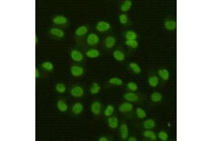 Immunocytochemistry staining of HeLa cells fixed with 4 % Paraformaldehyde and using FEN-1 mouse mAb (dilution 1:400). (FEN1 antibody)