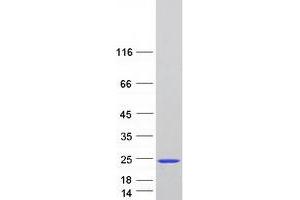 Western Blotting (WB) image for Short Coiled-Coil Protein (SCOC) (Transcript Variant 6) protein (Myc-DYKDDDDK Tag) (ABIN2731501)