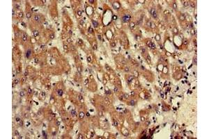 Immunohistochemistry of paraffin-embedded human liver tissue using ABIN7142740 at dilution of 1:100 (RPL12 antibody  (AA 1-99))