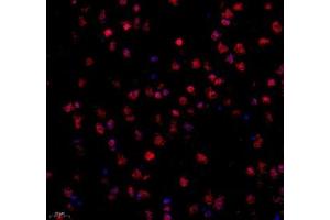 Immunofluorescence of paraffin embedded mouse corpus striatum using STRAD (ABIN7075730) at dilution of 1: 600 (400x lens) (STRADA antibody)