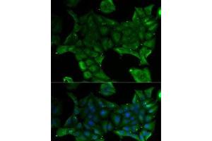 Immunofluorescence analysis of U2OS cells using SLC34A1 Polyclonal Antibody (Solute Carrier Family 34 (Type II Sodium/phosphate Contransporter), Member 1 (SLC34A1) antibody)