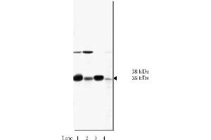 Western Blotting (WB) image for anti-N-Ethylmaleimide-Sensitive Factor Attachment Protein, alpha (NAPA) antibody (ABIN264390) (NAPA antibody)