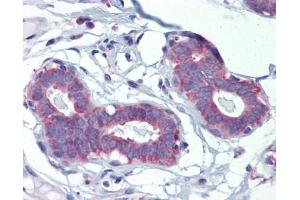 POLDIP3 antibody was used for immunohistochemistry at a concentration of 4-8 ug/ml. (POLDIP3 antibody)