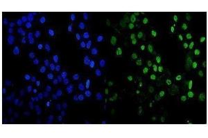 IF analysis of MDC1 using anti-MDC1 antibody (ABIN5693232). (MDC1 antibody  (AA 534-626))