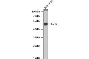 Western blot analysis of extracts of NCI-H125 cells, using CD1B Antibody (ABIN6130059, ABIN6138133, ABIN6138134 and ABIN6222219) at 1:1000 dilution. (CD1b antibody  (AA 18-303))
