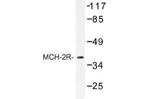 Image no. 1 for anti-Melanin-Concentrating Hormone Receptor 2 (MCHR2) antibody (ABIN317652) (MCHR2 antibody)