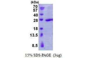 Figure annotation denotes ug of protein loaded and % gel used. (TBPL1 Protein)