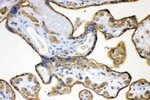 IHC analysis of SLC2A1 using anti-SLC2A1 antibody (ABIN3043927).