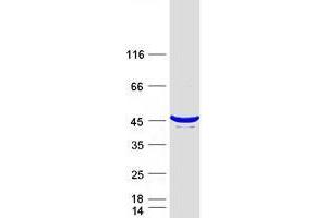 Tetratricopeptide Repeat Domain 1 (TTC1) protein (Myc-DYKDDDDK Tag)