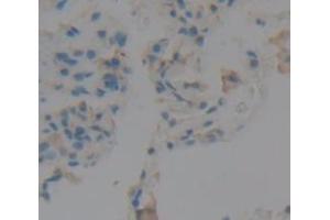 IHC-P analysis of Human Tissue, with DAB staining. (Peroxidasin antibody  (AA 1285-1475))