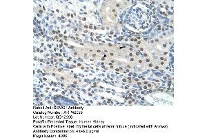 Rabbit Anti-SEMG1 Antibody  Paraffin Embedded Tissue: Human Kidney Cellular Data: Epithelial cells of renal tubule Antibody Concentration: 4. (SEMG1 antibody  (N-Term))