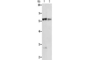 Gel: 10 % SDS-PAGE, Lysate: 50 μg, Lane 1-2: Jurkat cells, human fetal liver tissue, Primary antibody: ABIN7130695(PRCP Antibody) at dilution 1/200, Secondary antibody: Goat anti rabbit IgG at 1/8000 dilution, Exposure time: 5 minutes (PRCP antibody)