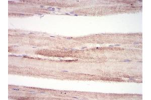 Immunohistochemical analysis of paraffin-embedded muscle tissues using MuRF1 mouse mAb with DAB staining. (TRIM63 antibody  (AA 293-304))
