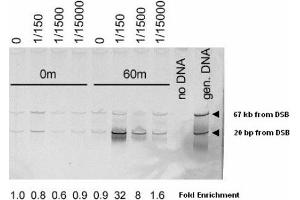 Image no. 1 for anti-MRE11 Meiotic Recombination 11 Homolog A (S. Cerevisiae) (MRE11A) (AA 578-590) antibody (ABIN401304) (Mre11 antibody  (AA 578-590))