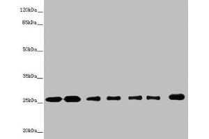 Western blot All lanes: RALB antibody at 1. (RALB antibody  (AA 1-206))