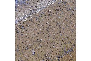 IHC analysis of TOM1L1 using anti-TOM1L1 antibody (ABIN7602631).