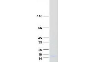 Melanoma Inhibitory Activity (MIA) protein (Myc-DYKDDDDK Tag)
