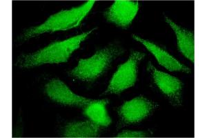 Immunofluorescence of monoclonal antibody to TF on HeLa cell. (Transferrin antibody  (AA 551-650))