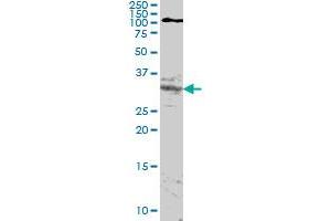 Western Blotting (WB) image for anti-Homeobox A11 (HOXA11) (AA 60-167) antibody (ABIN598748) (Homeobox A11 antibody  (AA 60-167))
