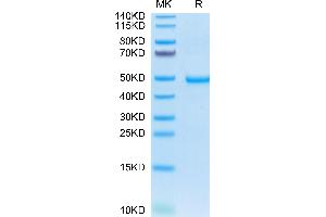 Human AREG on Tris-Bis PAGE under reduced condition. (Amphiregulin Protein (AREG) (AA 101-187) (Fc Tag))