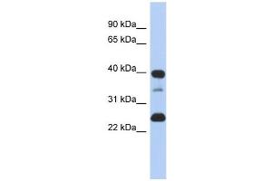Thymopoietin antibody used at 1 ug/ml to detect target protein. (Thymopoietin antibody  (N-Term))