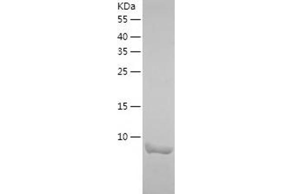 NUCB2 Protein (AA 25-106) (His tag)