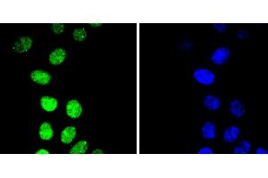 HepG2 cells were stained with Cyclin E1(T77) (4G10 ) Monoclonal Antibody  at [1:200] incubated overnight at 4C, followed by secondary antibody incubation, DAPI staining of the nuclei and detection. (Cyclin E1 antibody  (pThr77))