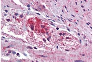 Human Colon, Myenteric Plexus: Formalin-Fixed, Paraffin-Embedded (FFPE) (KCTD15 antibody  (AA 36-85))