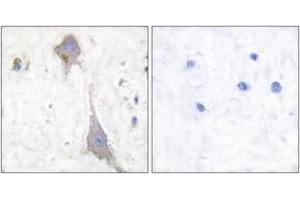Immunohistochemistry analysis of paraffin-embedded human brain tissue, using mGluR7 Antibody.