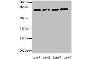 Western blot All lanes: TBC1D14 antibody at 4 μg/mL Lane 1: K562 whole cell lysate Lane 2: U87 whole cell lysate Lane 3: A549 whole cell lysate Lane 4: HepG2 whole cell lysate Secondary Goat polyclonal to rabbit IgG at 1/10000 dilution Predicted band size: 79, 48 kDa Observed band size: 79 kDa (TBC1D14 antibody  (AA 136-435))