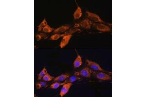 Immunofluorescence analysis of NIH/3T3 cells using  Rabbit pAb (ABIN7265482) at dilution of 1:100. (ARF4 antibody  (AA 1-180))