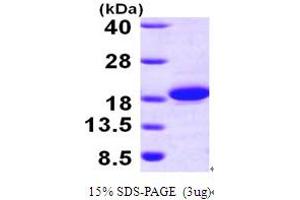 SDS-PAGE (SDS) image for Acyl-CoA Thioesterase 13 (ACOT13) (AA 1-140) protein (His tag) (ABIN667825)