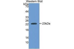 Western Blotting (WB) image for anti-Slow Skeletal Troponin I (TNNI1) (AA 142-187) antibody (ABIN1176053) (TNNI1 antibody  (AA 142-187))