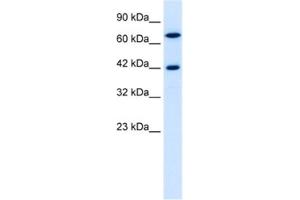 Western Blotting (WB) image for anti-TOX High Mobility Group Box Family Member 2 (TOX2) antibody (ABIN2460145) (TOX2 antibody)