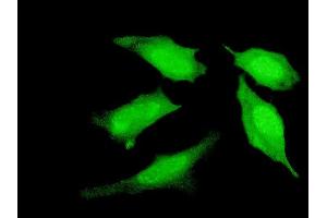 Immunofluorescence of monoclonal antibody to PRDM4 on HeLa cell. (PRDM4 antibody  (AA 476-575))