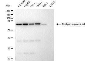 Western blotting analysis using Replication protein A1 antibody (ABIN7800172). (Recombinant RPA1 antibody)