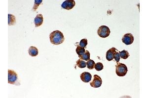 Anti- Parkin Picoband antibody, ICC ICC: NEURO-2α Cell (Parkin antibody  (AA 23-416))
