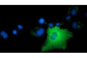 Anti-ARHGAP25 mouse monoclonal antibody (ABIN2452769) immunofluorescent staining of COS7 cells transiently transfected by pCMV6-ENTRY ARHGAP25 (RC217414). (ARHGAP25 antibody)