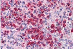 Spleen, Human: Formalin-Fixed, Paraffin-Embedded (FFPE) (ELANE antibody)