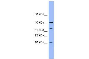 WB Suggested Anti-CASP6 Antibody Titration: 0. (Caspase 6 antibody  (Middle Region))