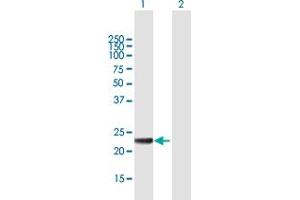 Western Blot analysis of MED20 expression in transfected 293T cell line by MED20 MaxPab polyclonal antibody. (MED20 antibody  (AA 1-212))