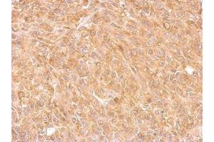 IHC-P Image AKR7A2 antibody detects AKR7A2 protein at cytosol on SkHep1 xenograft by immunohistochemical analysis. (AKR7A2 antibody)