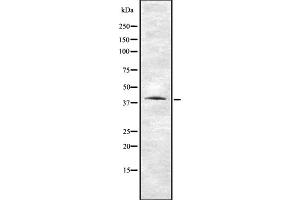 Western blot analysis of VN1R1 using HUVEC whole cell lysates (VN1R1 antibody  (N-Term))